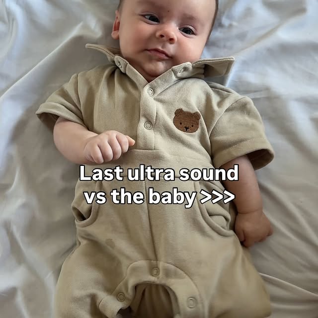 Marie Fe and Jake Snow: The last ultrasound photo already looked like him, don’t you think? 🥹😭