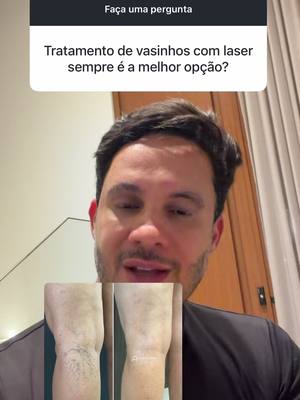 Rafael Alves de Oliveira: Laser é sempre a melhor opção para tratar vasinhos? 👀 Não. O laser é uma excelente técnica mas não serve para todo tipo
