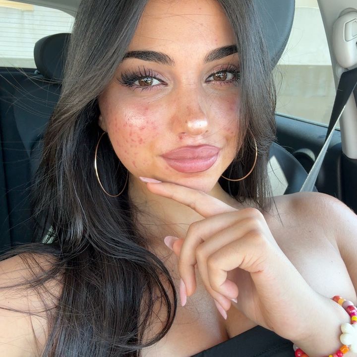 Anna Gegnoso